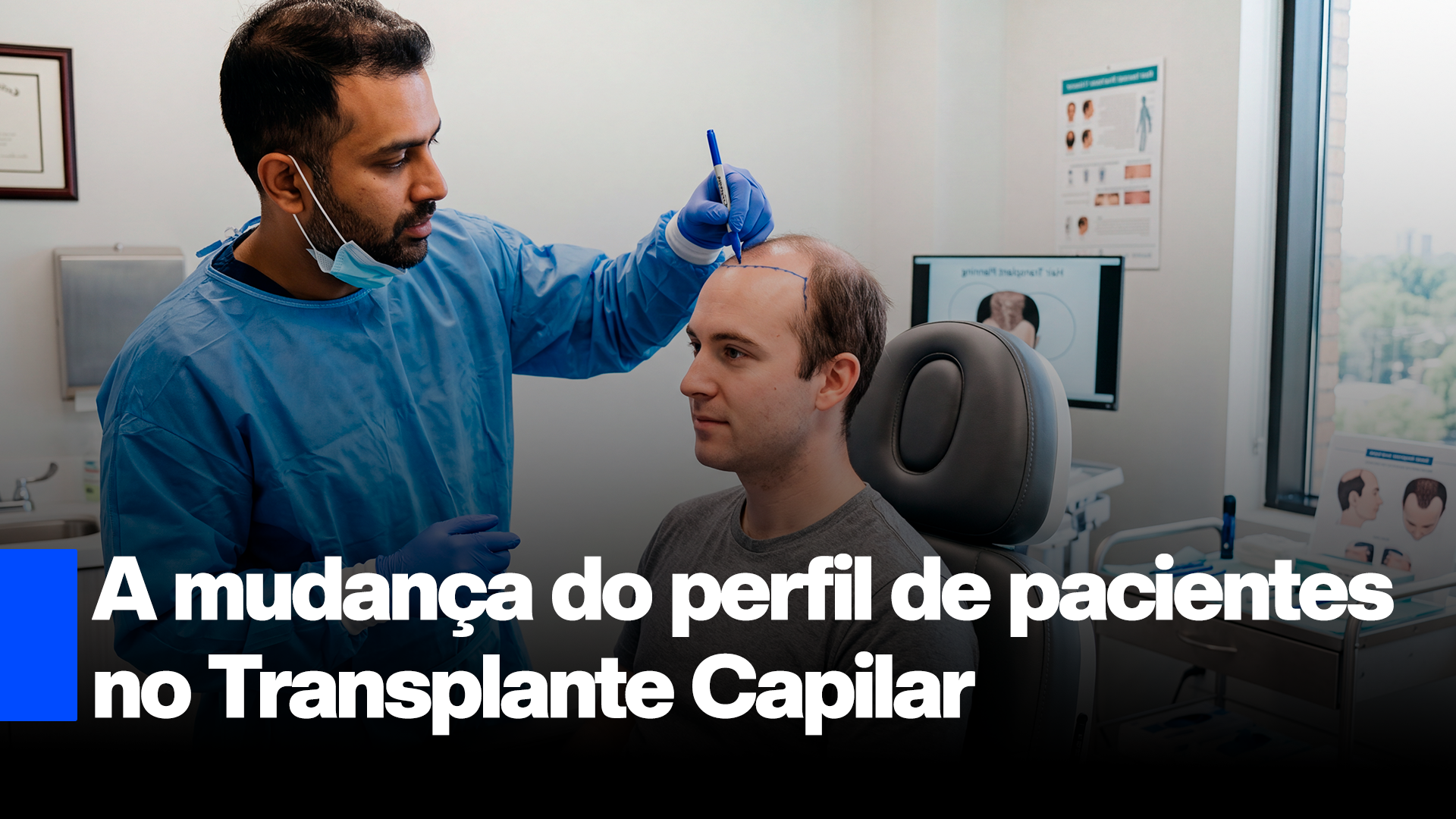 O paciente de transplante capilar tem 28 anos — e não compra como o de 45